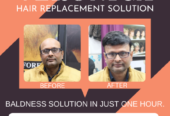 Best Hair Wig, Patch and Extension in Dwarka, New Delhi
