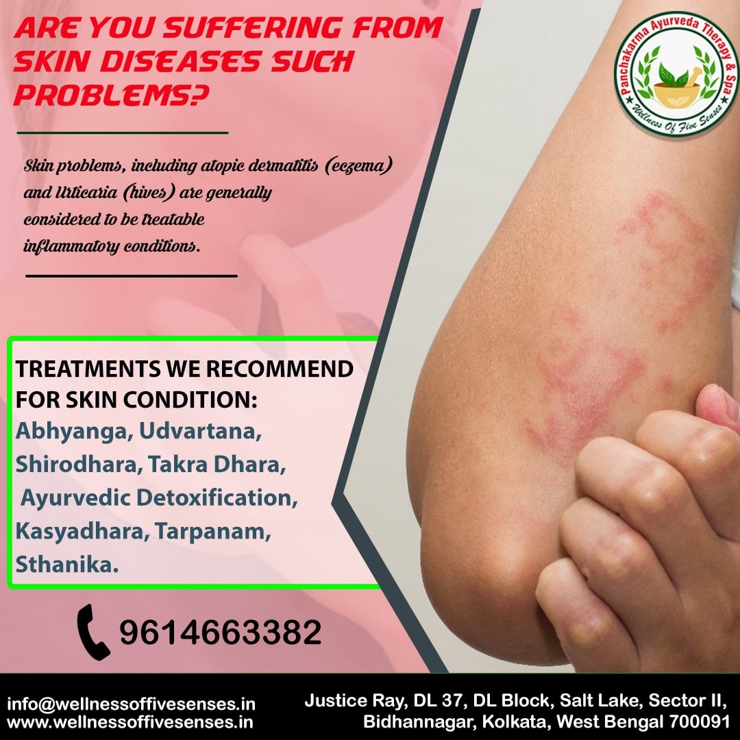 Ayurveda Treatments For Skin Diseases