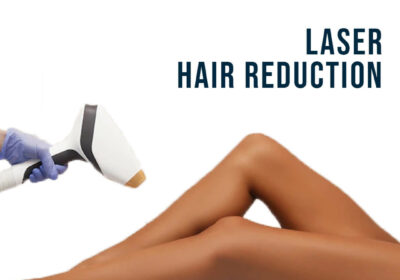 Laser-Hair-Reduction