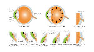 Best Eye Specialist Hospital in Patna | Chandigarh Eye Care Hospital