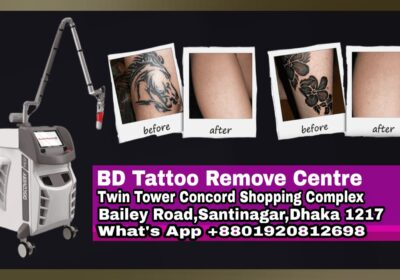 BD-Tattoo-Remove-Centre