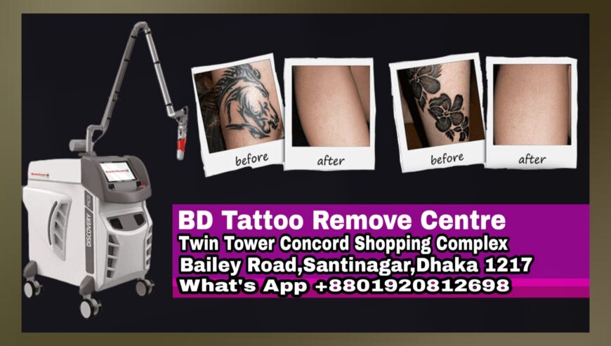 Top Tattoo Remove Center in Dhaka, Bangladesh | BD Tattoo Remove Centre