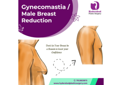Best Gynecomastia Surgery in Hyderabad | Hyderabad Plastic Surgery