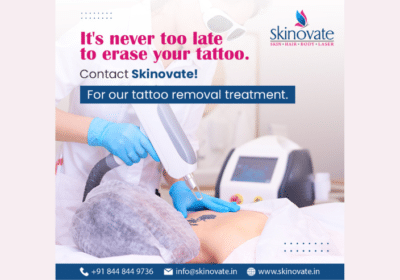 Best Clinic For Tattoo Removal in Pune | Skinovate Clinic