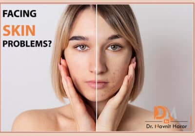 Facing-Skin-Problems
