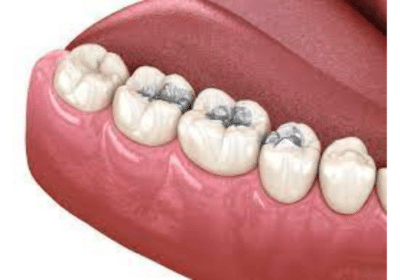 Choosing a Good Dental Clinic in Helensvale
