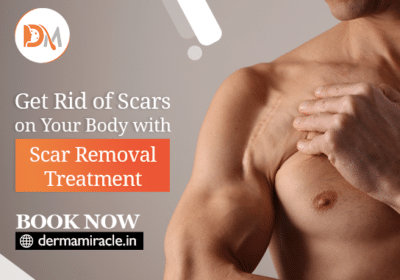 Best Scar Removal Clinic in Delhi | Derma Miracle