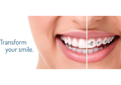 Best Dental Implants in Visakhapatnam | The Dental Studio