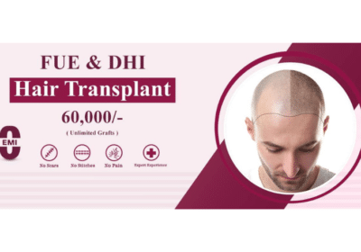 FUE Hair Transplant in Hyderabad | Layer’s Clinic