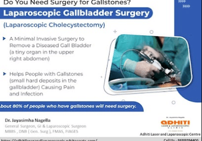 laproscopic-surgery