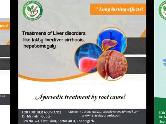 Ayurvedic-Treatment-For-Fatty-Liver