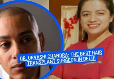 Best Hair Transplant Surgeon in Delhi | Dr. Urvashi Chandra