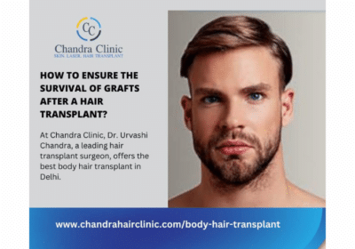 Get The Best Body Hair Transplant in Delhi | Chandra Clinic