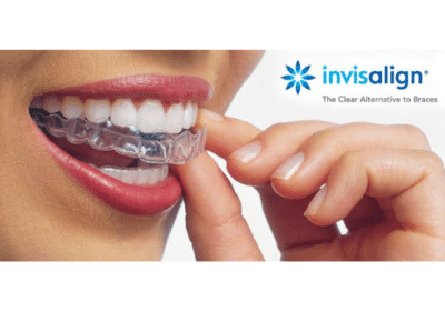 Invisalign-dental-clinic