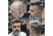 hair-systems-for-men