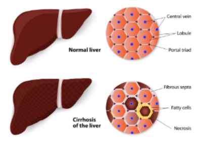 Best Liver Specialist Doctor in Ahmedabad | Dr. K S Purohit