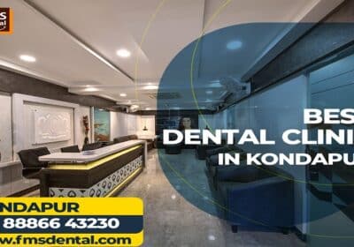 Enhance Your Smile with FMS DENTAL- Best Dental Clinic in Kondapur Hyderabad India