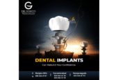 Best Dental Implants in Hyderabad | Dr. Gowd’s Dental Hospital