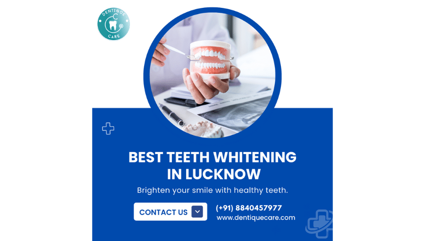 Best Teeth Whitening in Lucknow | Dentiquecare Dental Clinic