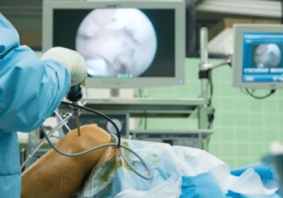 Knee Replacement in Dubai | Nanoori Hospital