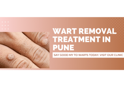 Top Doctors For Wart Removal Treatment in Pune | Urban Skin & Hair Clinic