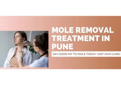 Best Mole Removal Treatment in Pune | Urban Skin & Hair Clinic