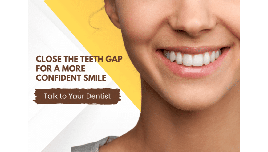 Permanent Solution For Missing Teeth | National Dental Care