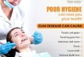 Best Dental Implants in Hyderabad | Dr. Gowd’s Dental Hospital