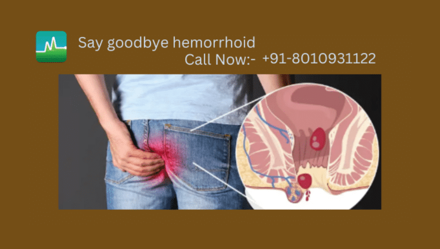 Best Lady Doctor For Piles Treatment in Delhi India | Dr. Monga Clinic