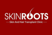 Acne Treatment in Delhi | Skin Roots Clinic