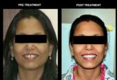 Best Orthodontist in Kolkata | Mission Smile Dental Centre