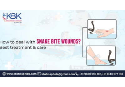 Snake Bite Treatment Hospital in Hyderabad | KBK Hospital
