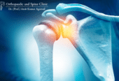 Shoulder Replacement Surgery in Delhi | Dr. Prof Amit Kumar Agarwal