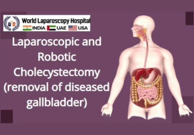 Laparoscopic and Robotic Cholecystectomy | World Laparoscopy Hospital