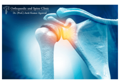 Shoulder-Replacement-Surgery-in-Delhi-Dr.-Prof-Amit-Kumar-Agarwal