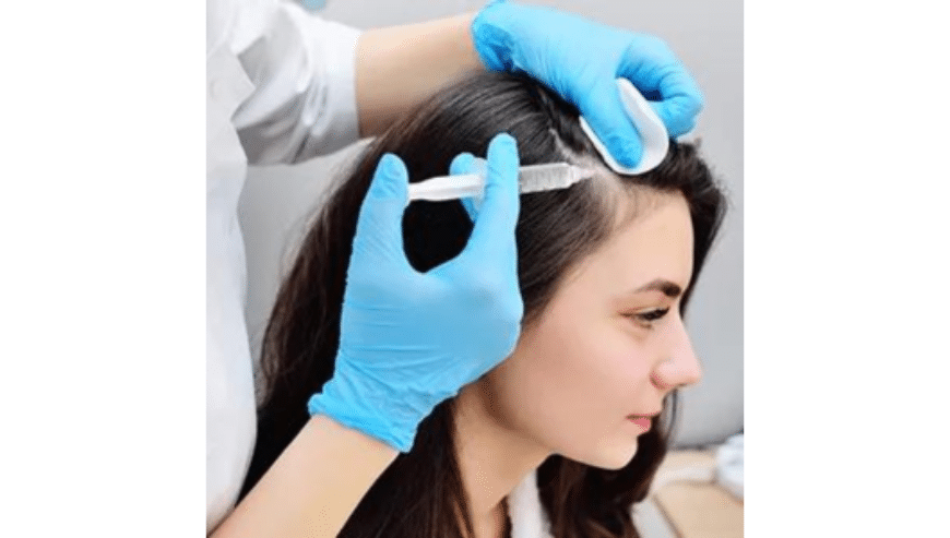 Best Hair Specialist in Noida | Skin Smith Clinic