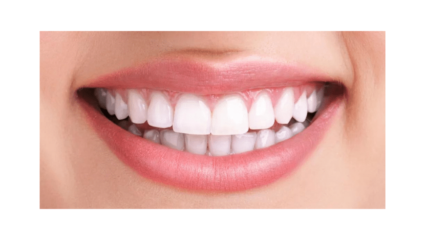 Radiant Smiles Await At The Teeth Whitening Boutique in UK | Belur Orthodontic