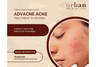 Discover Clear Skin – Acne Treatment in Mumbai’s Premier Clinic | Urban Skin and Hair Clinic
