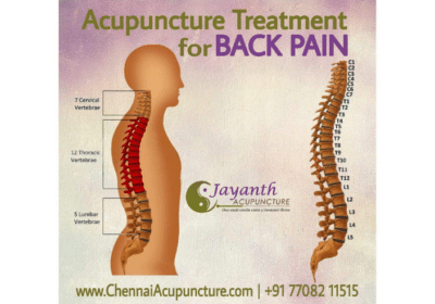 Best Acupuncture Treatment in Chennai | Best Acupuncturist Near Me in Annanagar | Jayanth Acupuncture Clinic