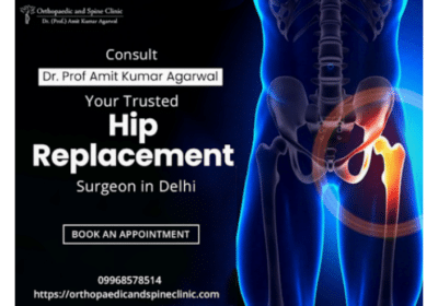 Best-Hip-Replacement-Surgeon-in-Delhi