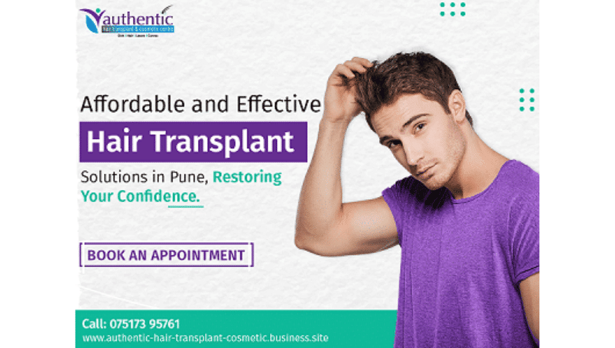 Get Your Hair Back with a Hair Transplant in Pune | Authentic Hair Transplant and Cosmetic Centre