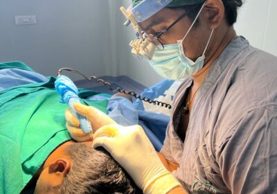 Best Hair Transplant Clinic in Hyderabad | Top Hair Transplant in Hyderabad