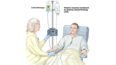 Chemotherapy Cost in India | Medsurge India