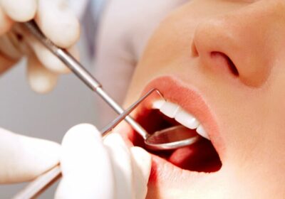 Dеntal Bracеs in Kurnool | Sara Dental Clinic