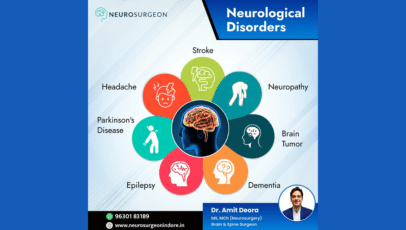 Empower Your Journey – Expert Epilepsy Care with Dr. Amit Deora