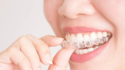 Multispeciality Dental Clinic Panchkula | DentXperts Clinic
