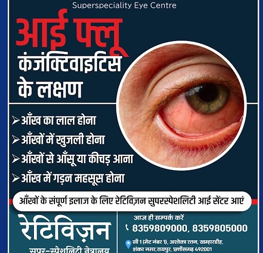 Symptoms of Eye Flu Conjunctivitis | Retivision Superspeciality Eye Centre