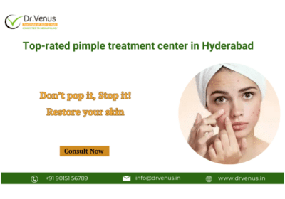 Top-Rated Pimple Treatment Center in Hyderabad | Dr. Venus