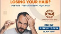 Best Hair Transplant in Hyderabad | Radiance Hair Transplantation Clinics