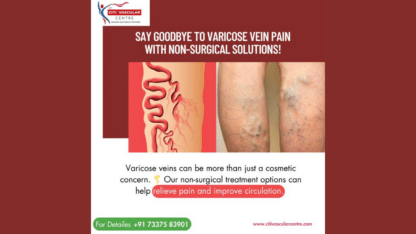 Best-Doctor-For-Varicose-Veins-in-Hyderabad-Citi-Vascular-Centre